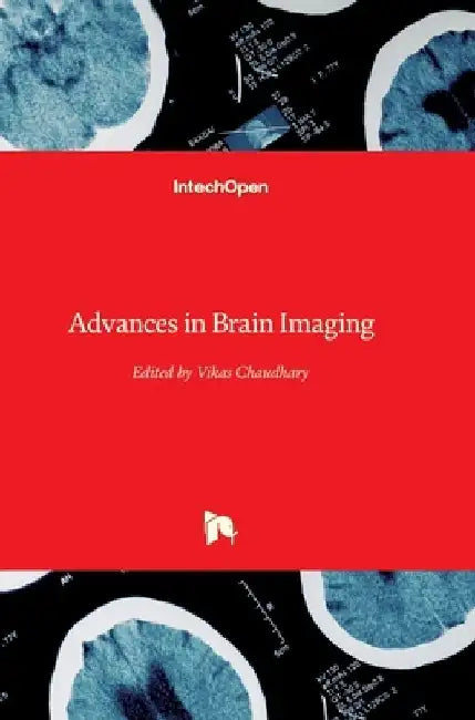 Advances in Brain Imaging by Vikas Chaudhary