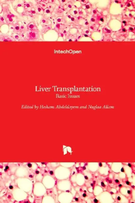 Liver Transplantation: Basic Issues by Naglaa Allam