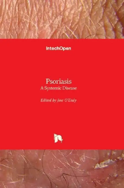Psoriasis: A Systemic Disease by Jose O' Daly