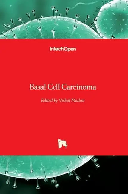 Basal Cell Carcinoma by Vishal Madan
