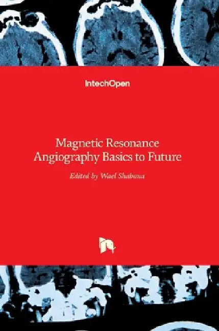 Magnetic Resonance Angiography: Basics to Future by Wael Shabana
