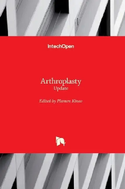 Arthroplasty: Update by Plamen Kinov