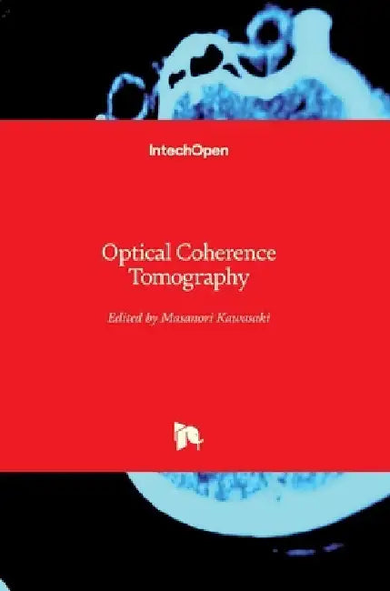 Optical Coherence Tomography by Masanori Kawasaki