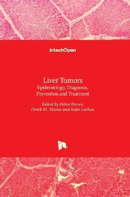 Liver Tumors: Epidemiology, Diagnosis, Prevention and Treatment by Helen Reeves