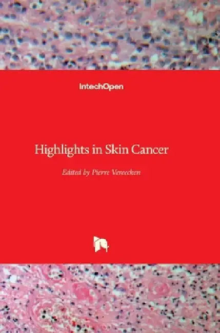 Highlights in Skin Cancer by Pierre Vereecken