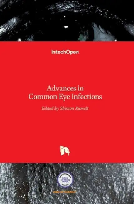 Advances in Common Eye Infections by Shimon Rumelt