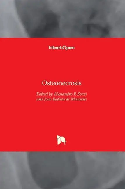 Osteonecrosis by Alessandro Rozim Zorzi