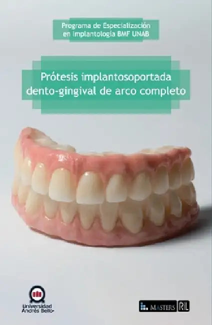 Prótesis implantosoportada dento-gingival de arco completo by Programa de Especialización