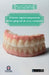 Prótesis implantosoportada dento-gingival de arco completo by Programa de Especialización