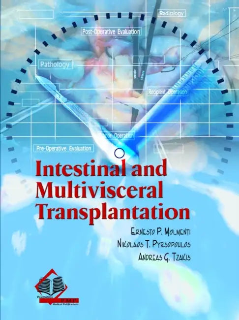 Intestinal And Multivisceral Transplantation by Molmenti