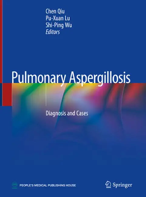 Pulmonary Aspergillosis: Diagnosis and Cases by Chen Qiu