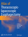 Atlas of Thoracoscopic-Lapacoscopic Esophagectomy by Yi Zhang