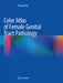 Color Atlas of Female Genital Tract Pathology by Pranab Dey