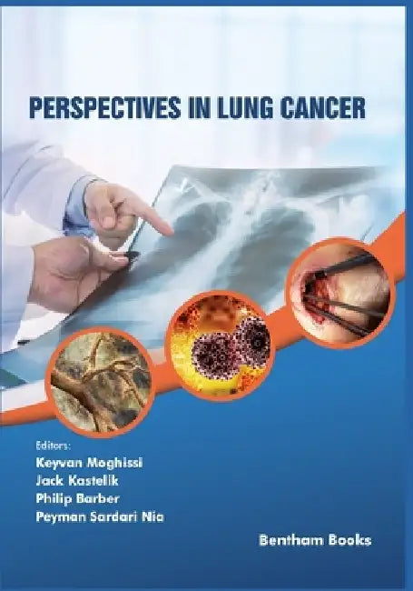 Perspectives in Lung Cancer by Jack Kastelik