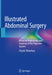 Illustrated Abdominal Surgery: Based on Embryology and Anatomy of the Digestive System by Hisashi Shinohara