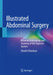 Illustrated Abdominal Surgery: Based on Embryology and Anatomy of the Digestive System by Hisashi Shinohara