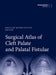 Surgical Atlas of Cleft Palate and Palatal Fistulae by Ghulam Qadir Fayyaz