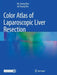 Color Atlas of Laparoscopic Liver Resection by Ho-Seong Han