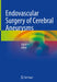 Endovascular Surgery of Cerebral Aneurysms by Xianli LV