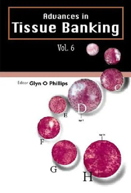 Advances in Tissue Banking (V6) by Phillips Glyn O