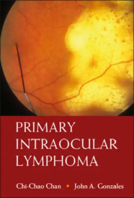 Primary Intraocular Lymphoma by Chi-Chao Chan, John A. Gonzales