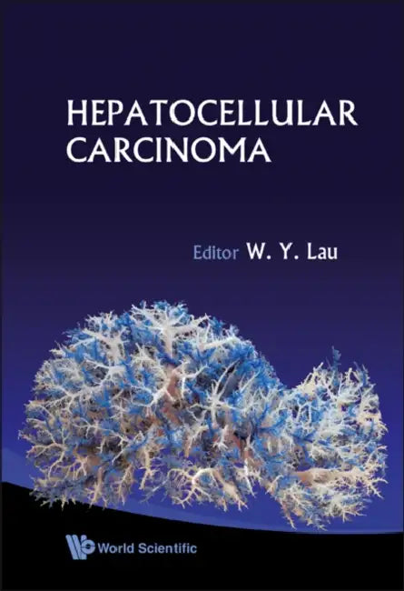 Hepatocellular Carcinoma by Joseph W. Y. Lau