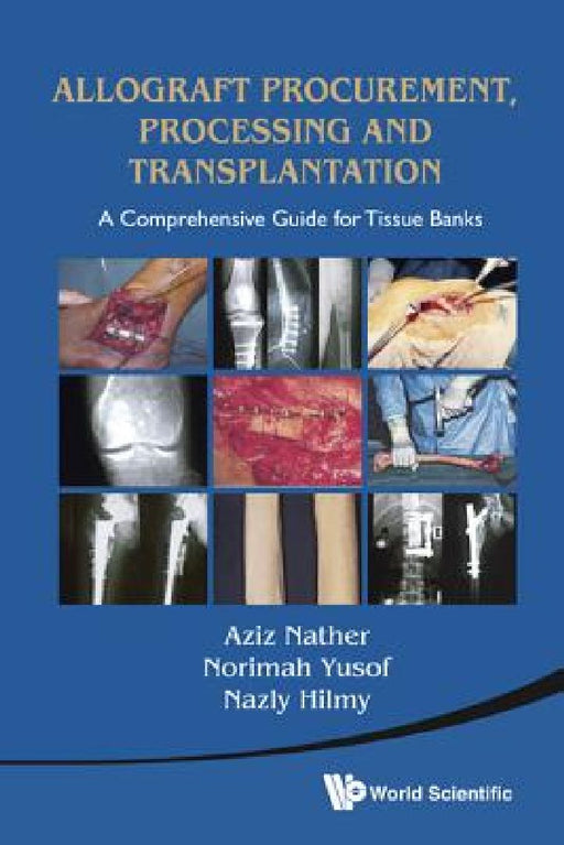 Allograft Procurement, Processing and Transplantation: A Comprehensive Guide for Tissue Bank by Norimah Yusof