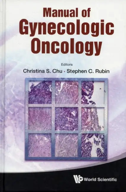 Manual of Gynecologic Oncology by Stephen C. Rubin, Christina S. Chu
