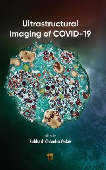 Ultrastructural Imaging of Covid-19 by Subhash Chandra Yadav
