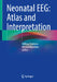 Neonatal Eeg: Atlas and Interpretation by Akihisa Okumura