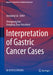 Interpretation of Gastric Cancer Cases by Jianqiang Cai
