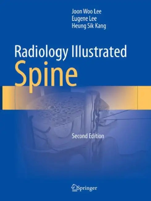 Radiology Illustrated: Spine by Joon Woo Lee