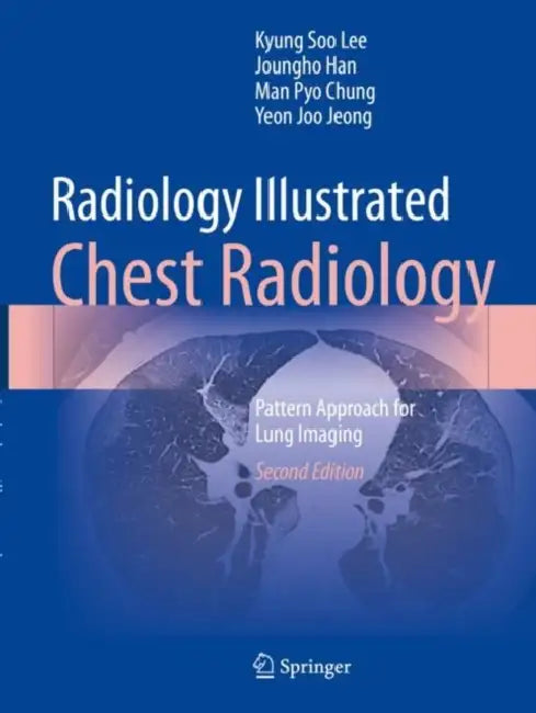 Radiology Illustrated: Chest Radiology by Kyung Soo Lee