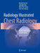 Radiology Illustrated: Chest Radiology by Kyung Soo Lee