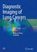 Diagnostic Imaging of Lung Cancers by Song Zhang