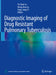 Diagnostic Imaging of Drug Resistant Pulmonary Tuberculosis by Pu-Xuan Lu
