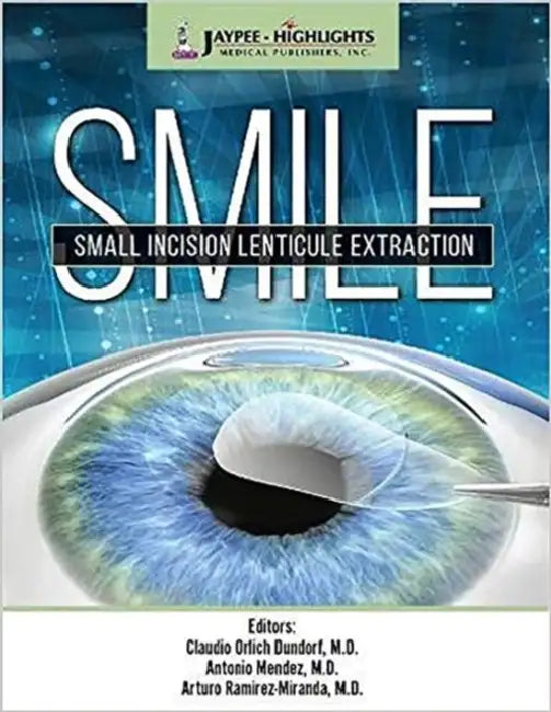Smile: Small Incision Lenticule Extraction by Claudio Orlich Dunddorf