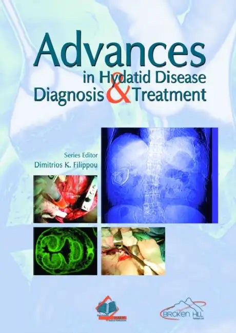 Advances In Hydatid Disease Diagnosis & Treatment by Filippou