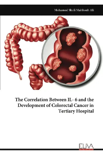 The Correlation Between IL- 6 and the Development of Colorectal Cancer in Tertiary Hospital by Mohamed Shafi Mahboob Ali