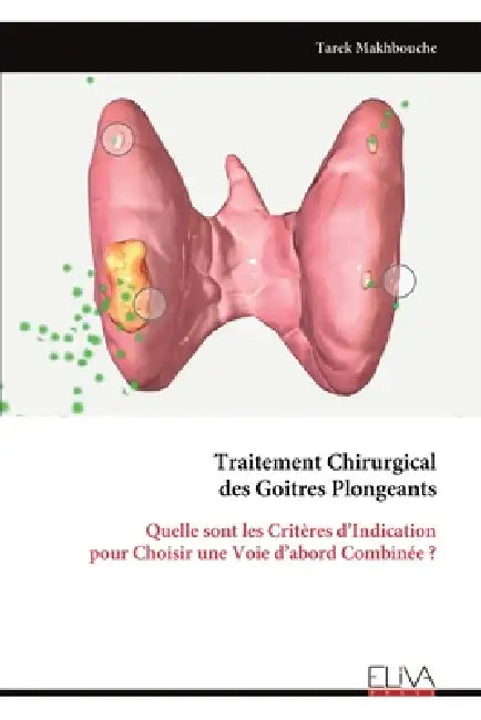Traitement Chirurgical des Goitres Plongeants: Quelle sont les Critères d'Indication pour Choisir une Voie d'abord Combinée ? by Tarek Makhbouche
