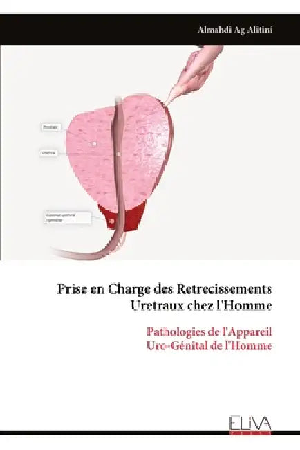Prise en Charge des Retrecissements Uretraux chez l'Homme: Pathologies de l'Appareil Uro-Génital de l'Homme by Almahdi Ag Alitini