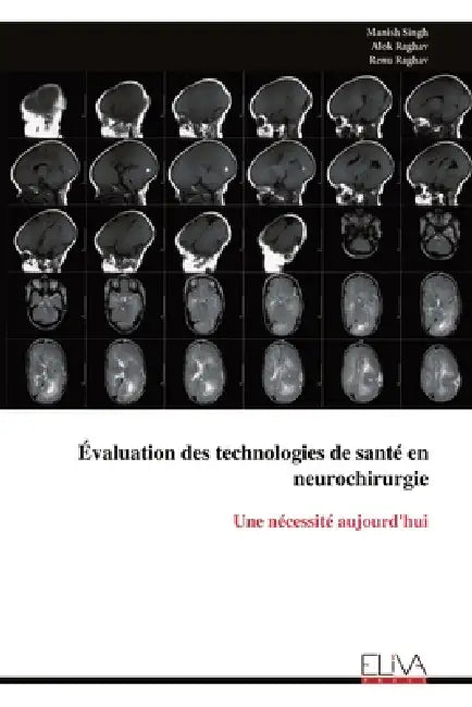 Évaluation des technologies de santé en neurochirurgie: Une nécessité aujourd'hui by Manish Singh