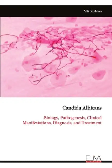 Candida Albicans: Biology, Pathogenesis, Clinical Manifestations, Diagnosis, and Treatment by Alfi Sophian