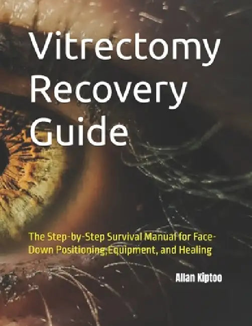 Vitrectomy Recovery Guide: The Step-by-Step Survival Manual for Face-Down Positioning, Equipment, and Healing by Allan Kiptoo