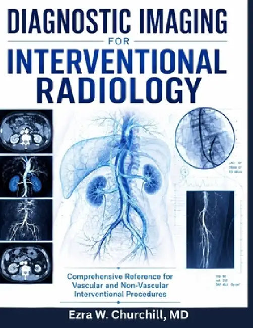 Diagnostic Imaging for Interventional Radiology: Comprehensive Reference for Vascular and Non-Vascular Interventional Procedures by Ezra W. Churchill