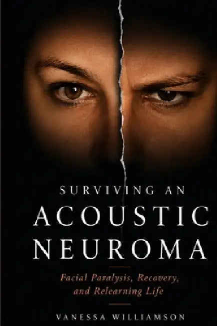 Surviving an Acoustic Neuroma: Facial Paralysis, Recovery, and Relearning Life by Vanessa Williamson