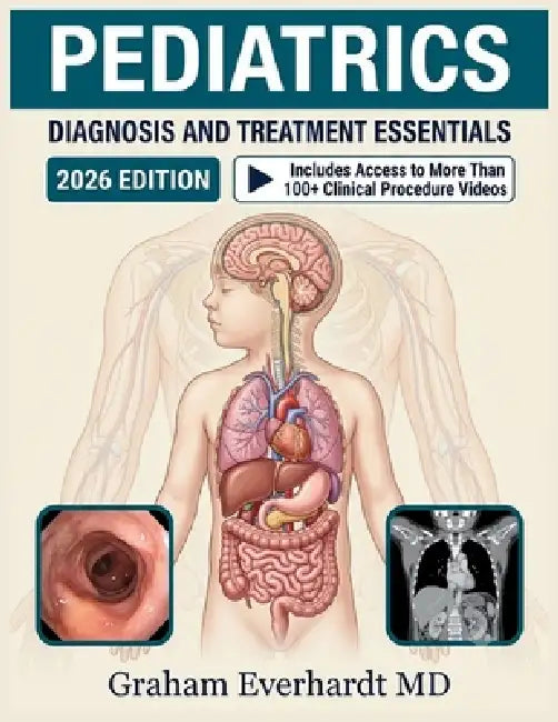 Pediatrics Diagnosis and Treatment Essentials: A Clinical Guide to Common Childhood Conditions, Dosing, and Evidence-Based Management by Graham Everhardt
