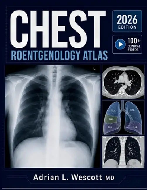 Chest Roentgenology Atlas: Systematic Image Interpretation, Differential Diagnosis of Pulmonary Findings, and Evidence-Based Decision Support for Radi by Adrian L. Wescott