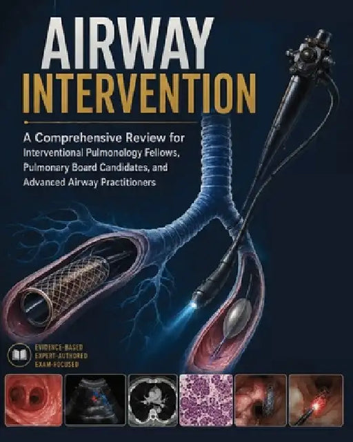 Airway Intervention: A Comprehensive Review for Interventional Pulmonology Fellows, Pulmonary Board Candidates, and Advanced Airway Practitioners by Virginia Janet