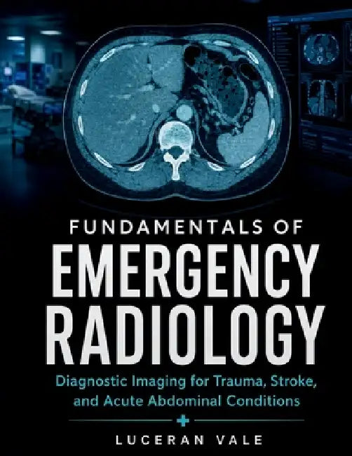 Fundamentals of Emergency Radiology: Diagnostic Imaging for Trauma, Stroke, and Acute Abdominal Conditions by Luceran Vale